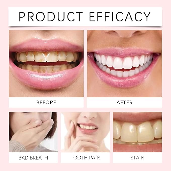 معجون أسنان أورالهو - نيكوتيناميد المبيض