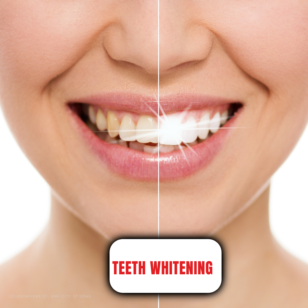 best whitening kits Pakistan modern teeth whitening system UAE Saudi Arabia buy online premium care